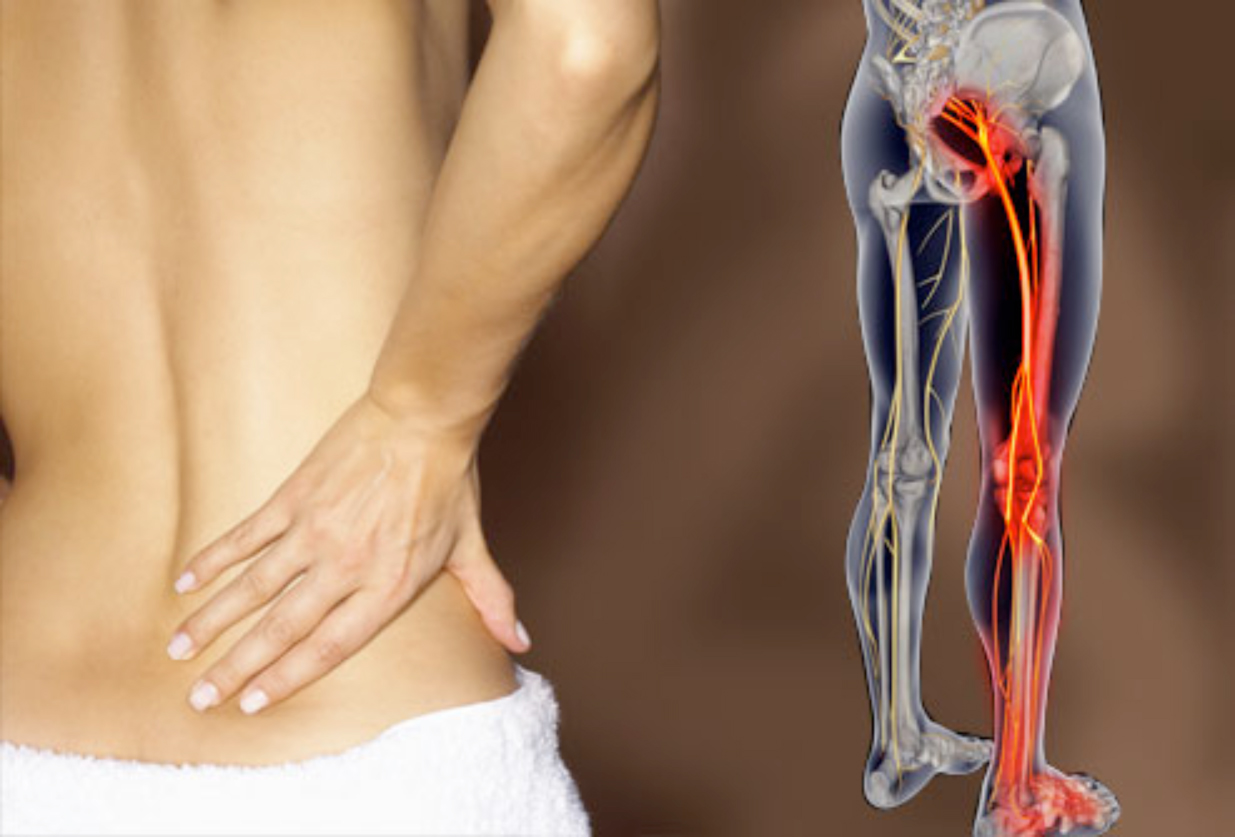 Louise O'Rourke Physiotherapy - Mat Pilates Classes - Kingswood Citywest Naas Dublin